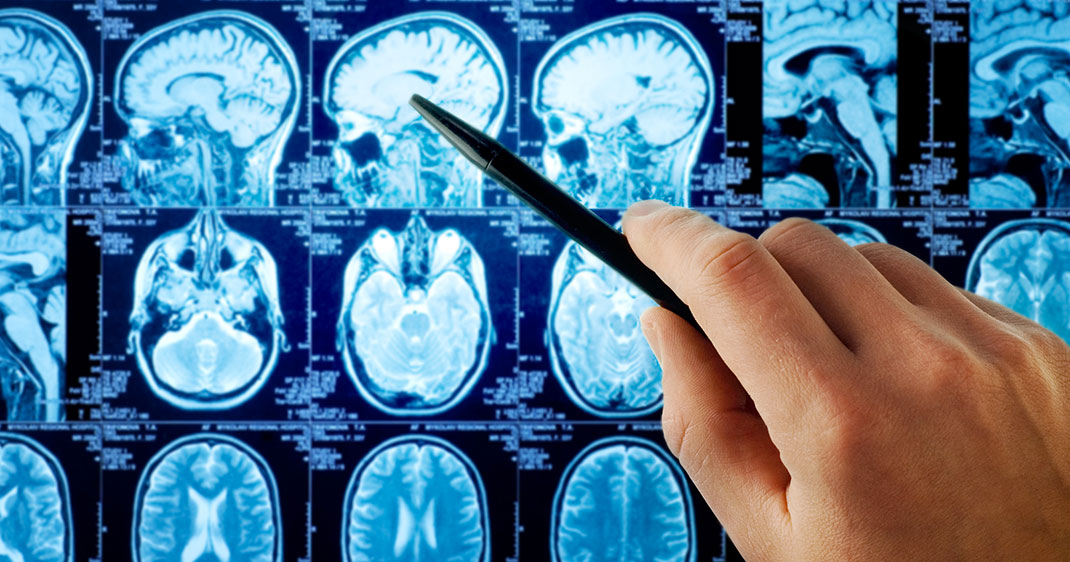 une-scanner-cerveau
