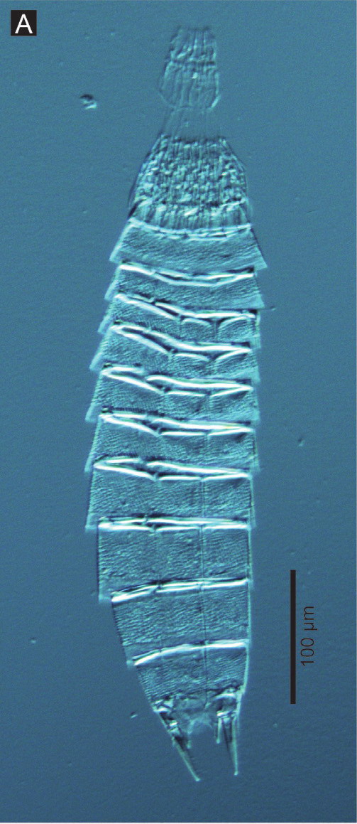 Kinorhyncha