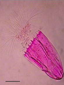 Loricifera