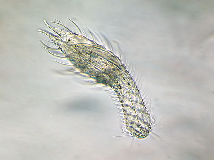gastrotriche