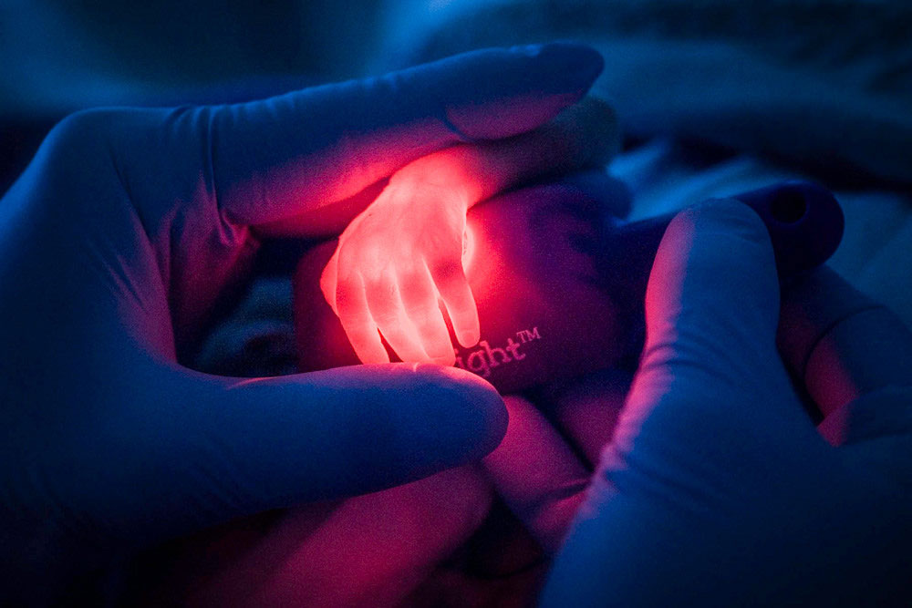 Une lumière révèle les veines d'un bébé prématuré