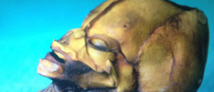 ladn-data-extraterrestre-humanoide-decouvert-au-chili-vient-detre-analyse-une