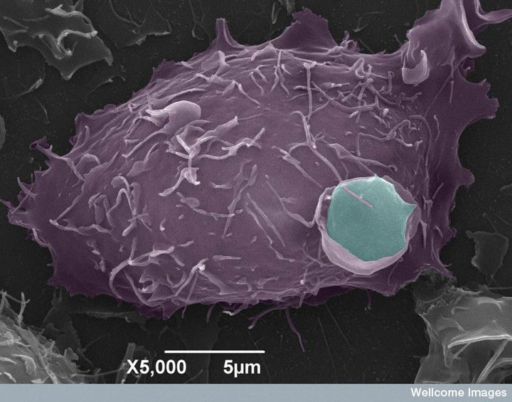 des-chercheurs-francais-parviennent-a-eliminer-les-reservoirs-du-virus-du-sida-dans-le-corps1