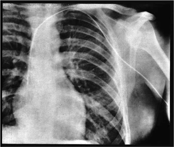 10-scientifiques-qui-se-sont-sacrifies-pour-la-science6