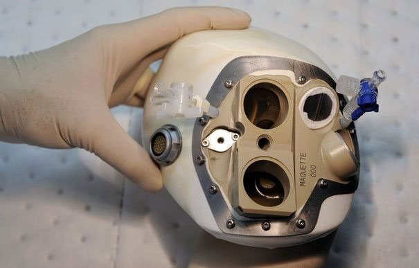 le-coeur-artificiel-carmat-sera-bientot-transplante-dans-de-nouveaux-patients1
