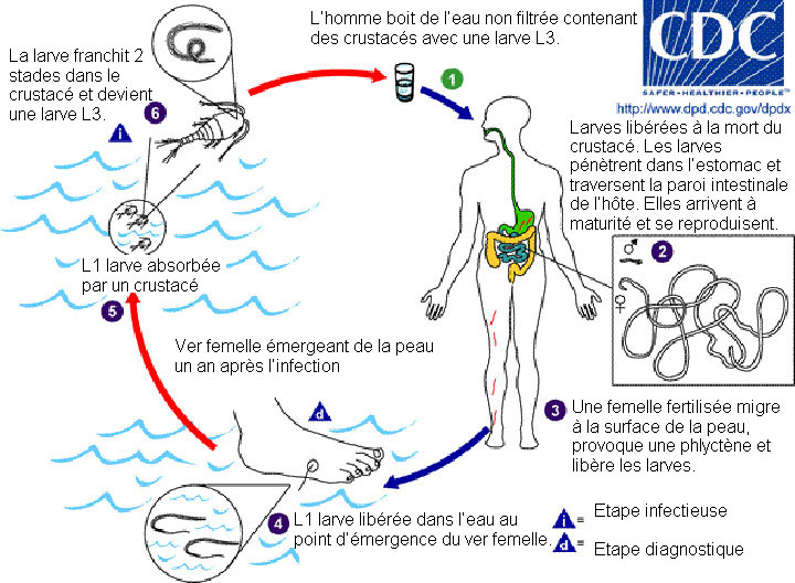le-dracunculose-un-ver-parasite-absolument-horrifiant-qui-elit-domicile-dans-le-corps-humain