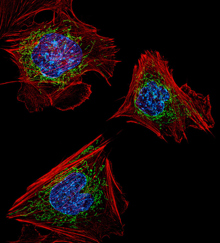 voici-les-gagnants-de-limage-microscopique-de-lannee-20135