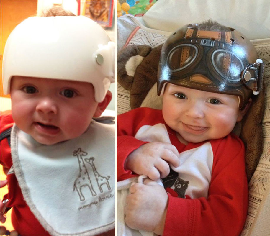 casque-bébé-16