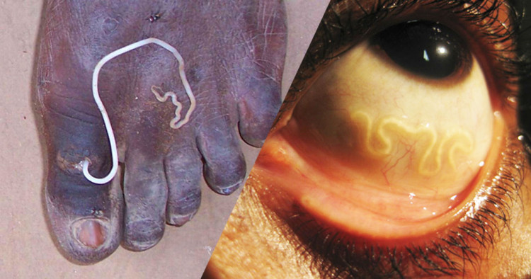 parasites-une