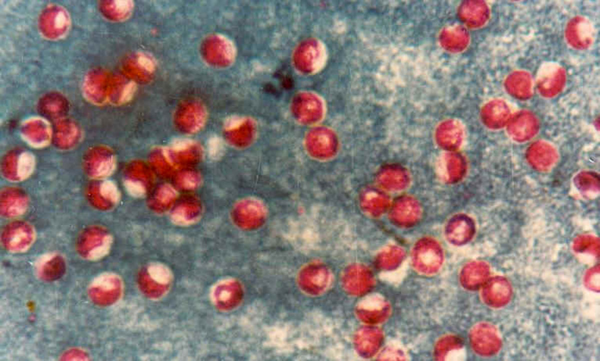 Cryptosporidium-spp