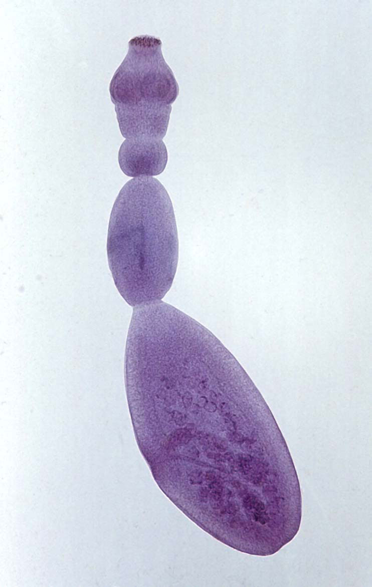 Echinococcus-Granulosus2