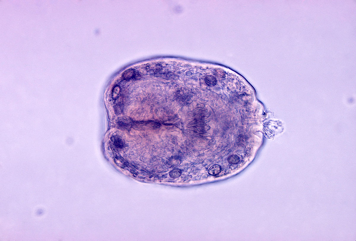 Echinococcus-granulosus
