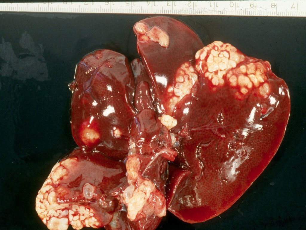 Echinococcus-multilocularis2