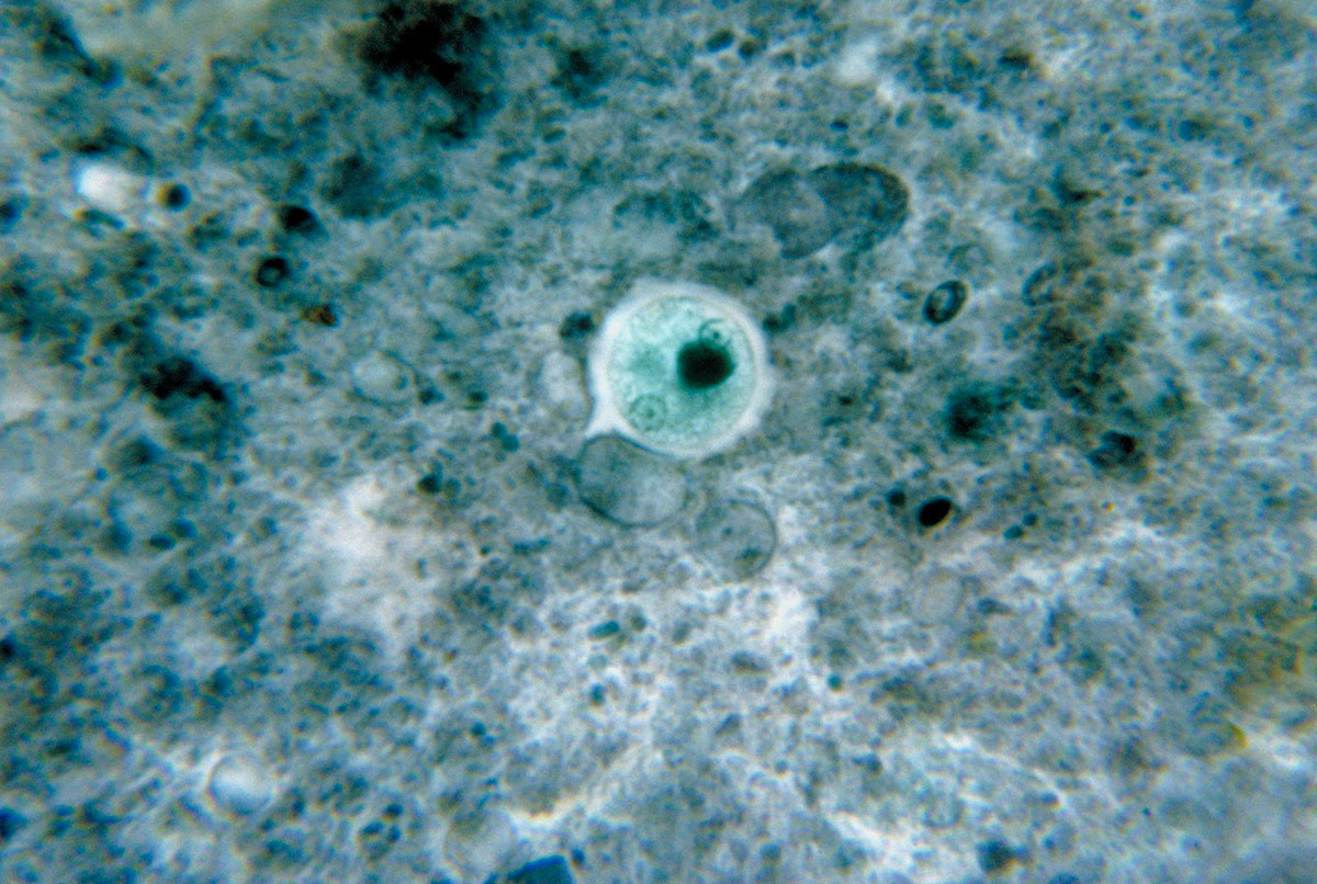 Entamoeba-histolytica