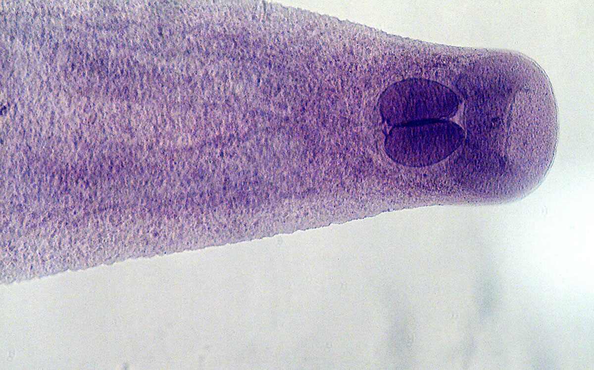 Opisthorchiidae
