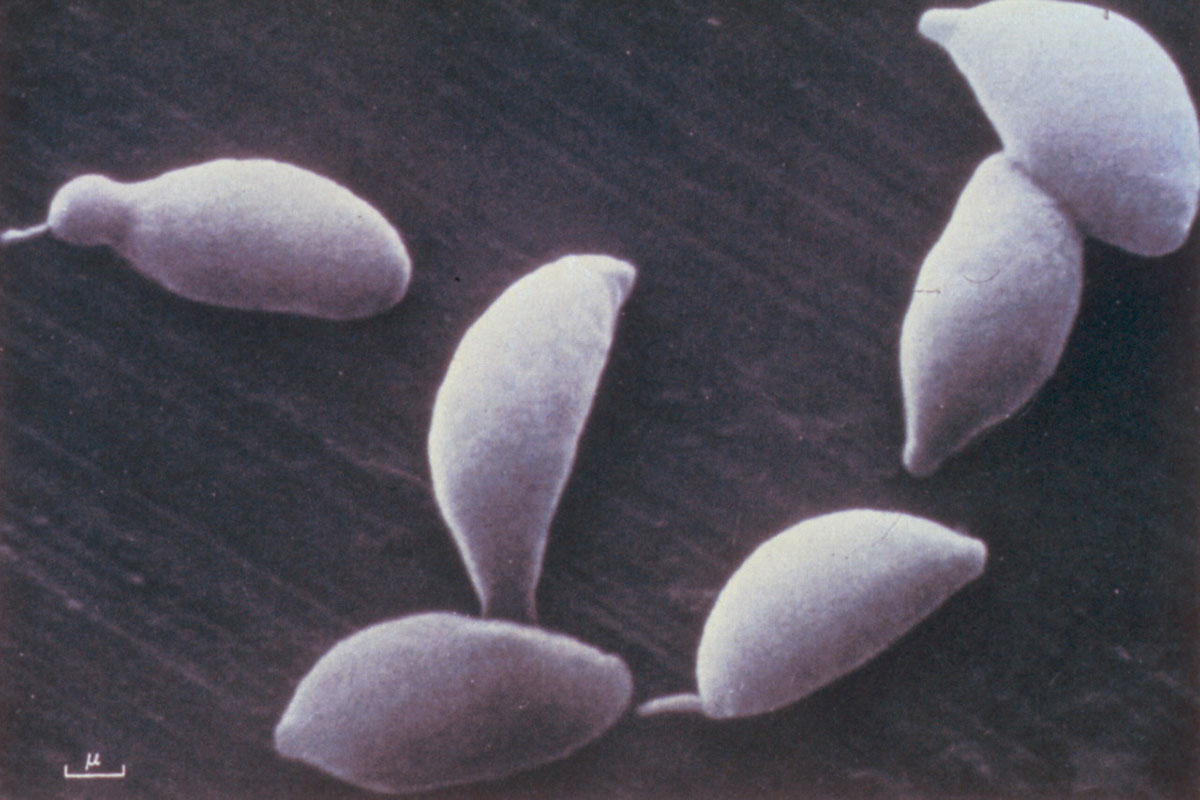 Toxoplasma-Gondii2