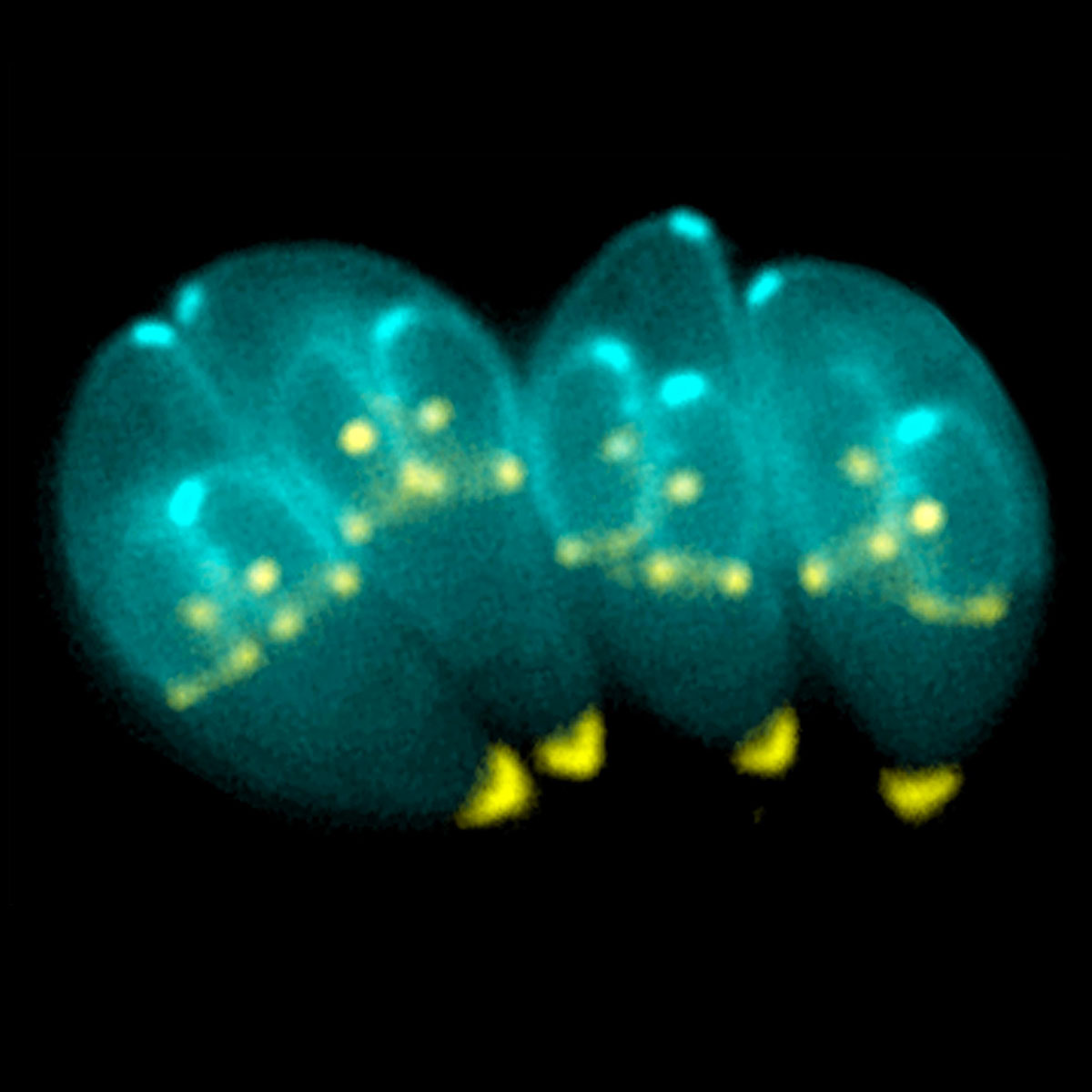 Toxoplasma-gondii