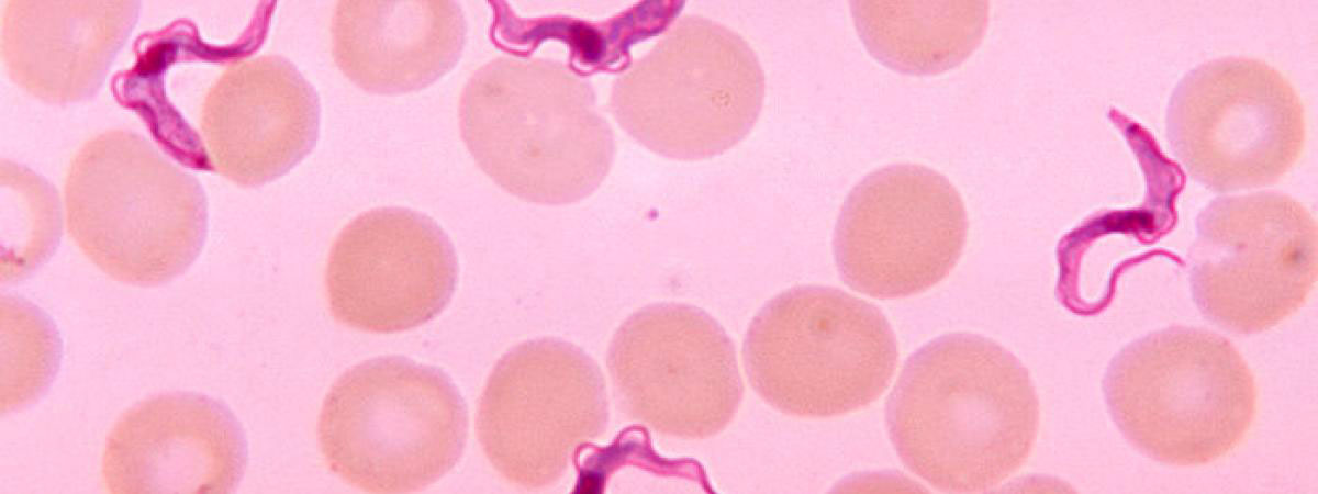 Trypanosoma-Cruzi2