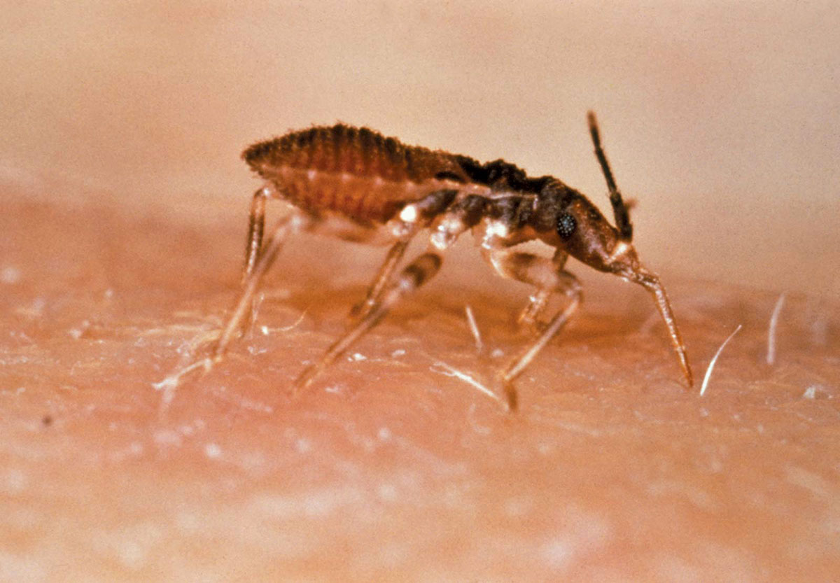 Trypanosoma-cruzi