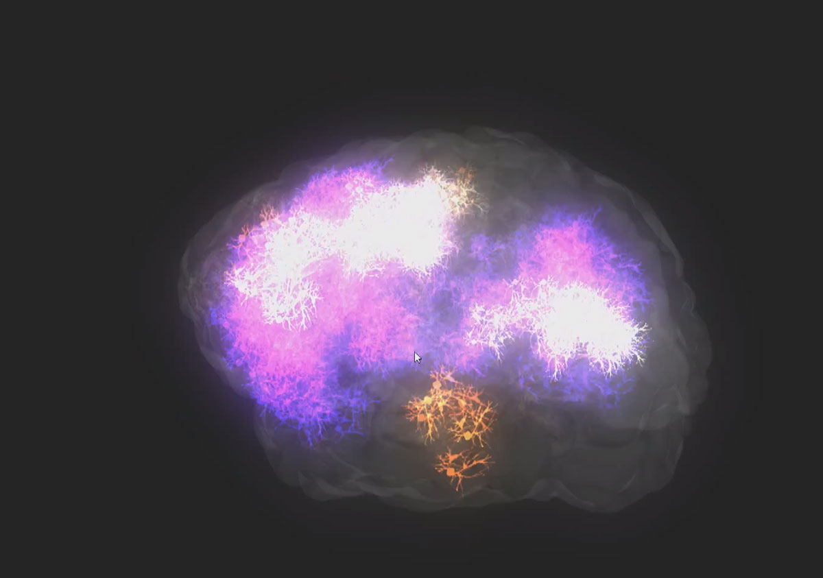 activite-cerveau