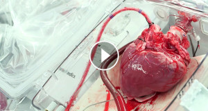 coeur-exterieur