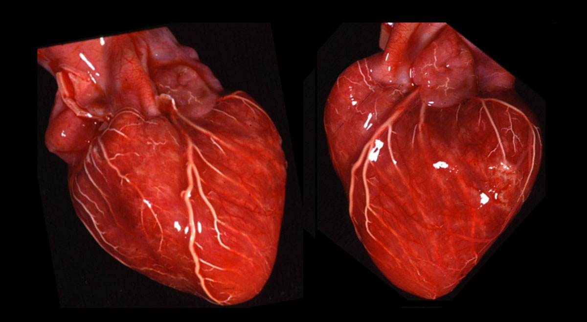 coeur