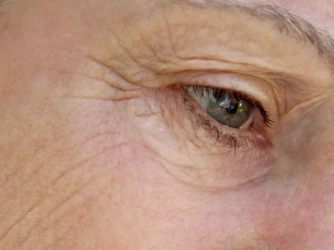 oeil-femme-senior-risque-dmla