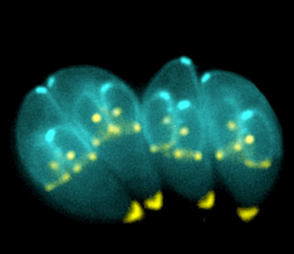 Toxoplasma_gondii
