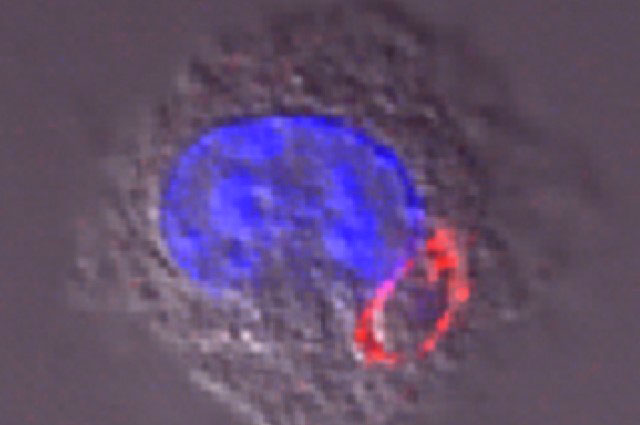 cellule-toxoplasma-gondii
