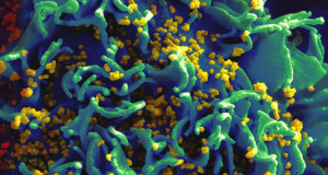 vih-attaque-cancer