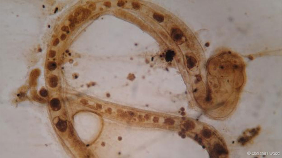 31-animaux-groupes-rhombozoa