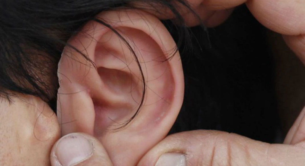 oreille-artificielle-prothese