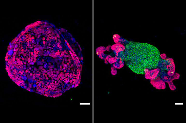 gene-reactivation-colorectal-cancer-cells-normal-tissue
