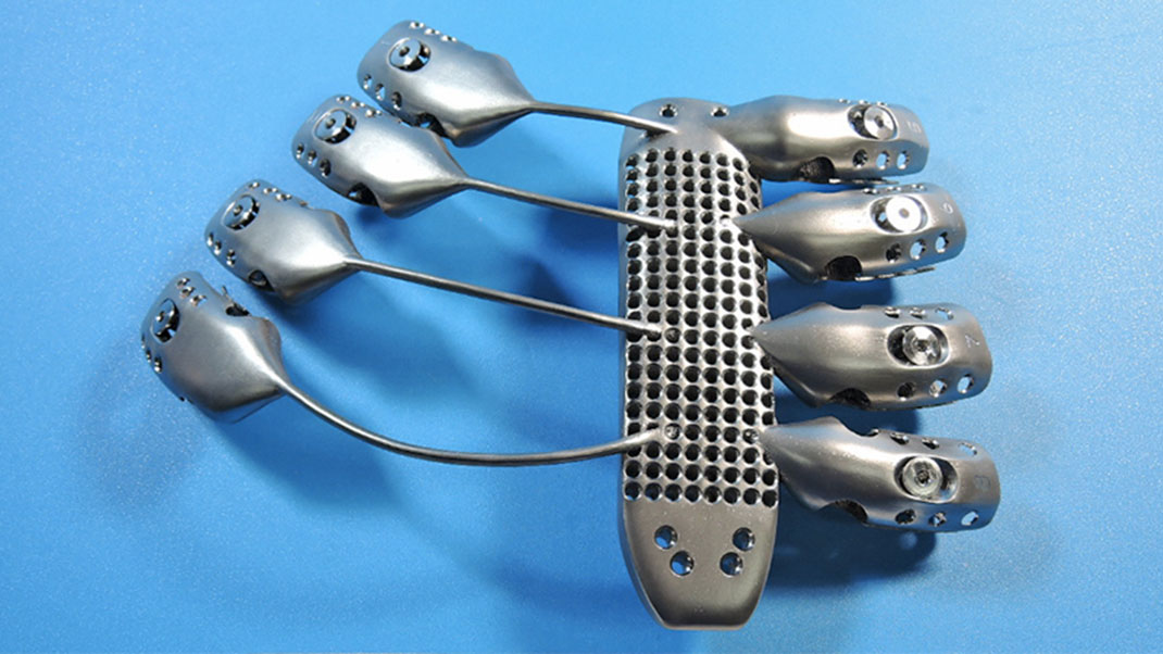 cage-thoracique-3D