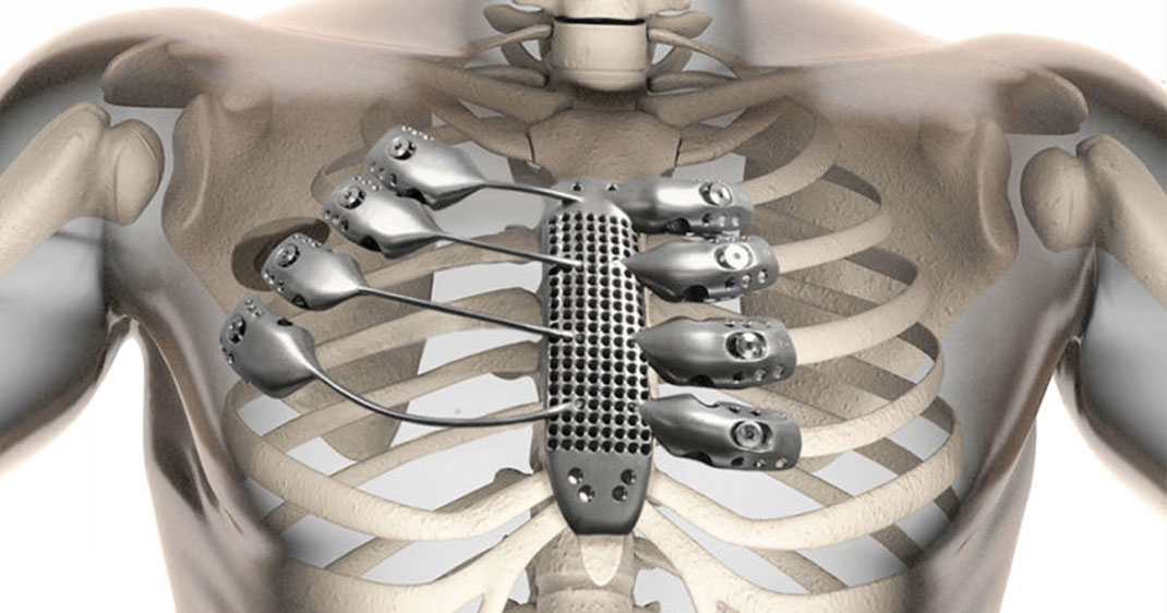 une-cage-thoracique-3D