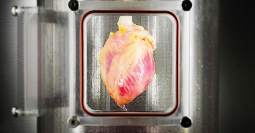 coeur-greffe-cellules-souches-une
