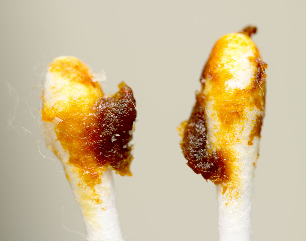 Du cérumen via Shutterstock